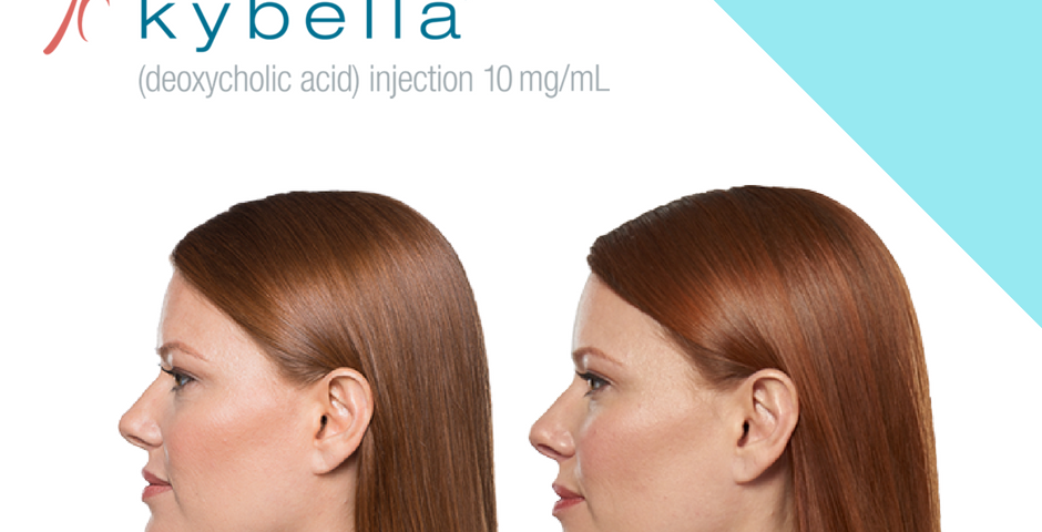 How long does Kybella Last