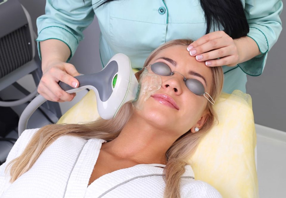 IPL Photofacial