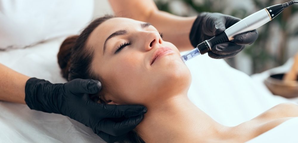 What Is Microneedling and What are the Benefits?
