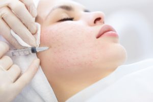 As microneedling is a medical procedure, some risks exist