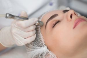  Microdermabrasion Treat Acne Scars