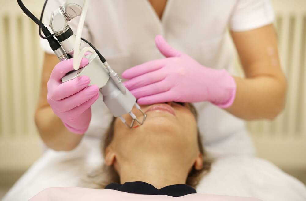 Laser Surfacing for Better Skin| SPA MD