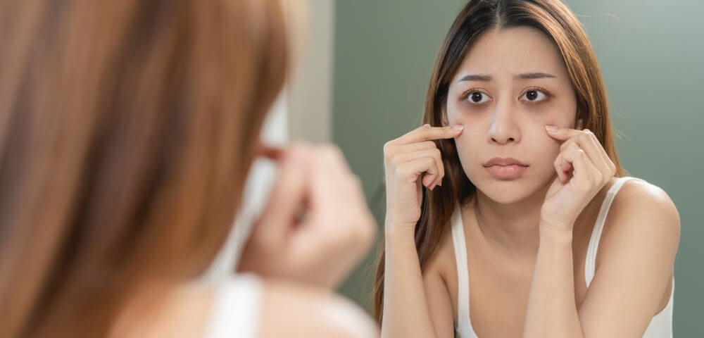 Tips For Preventing Under Eye Bags and Dark Circles