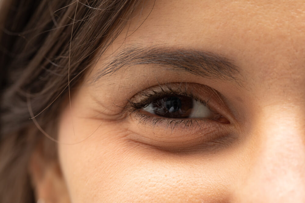 A foolproof guide to dealing with your under-eye concerns