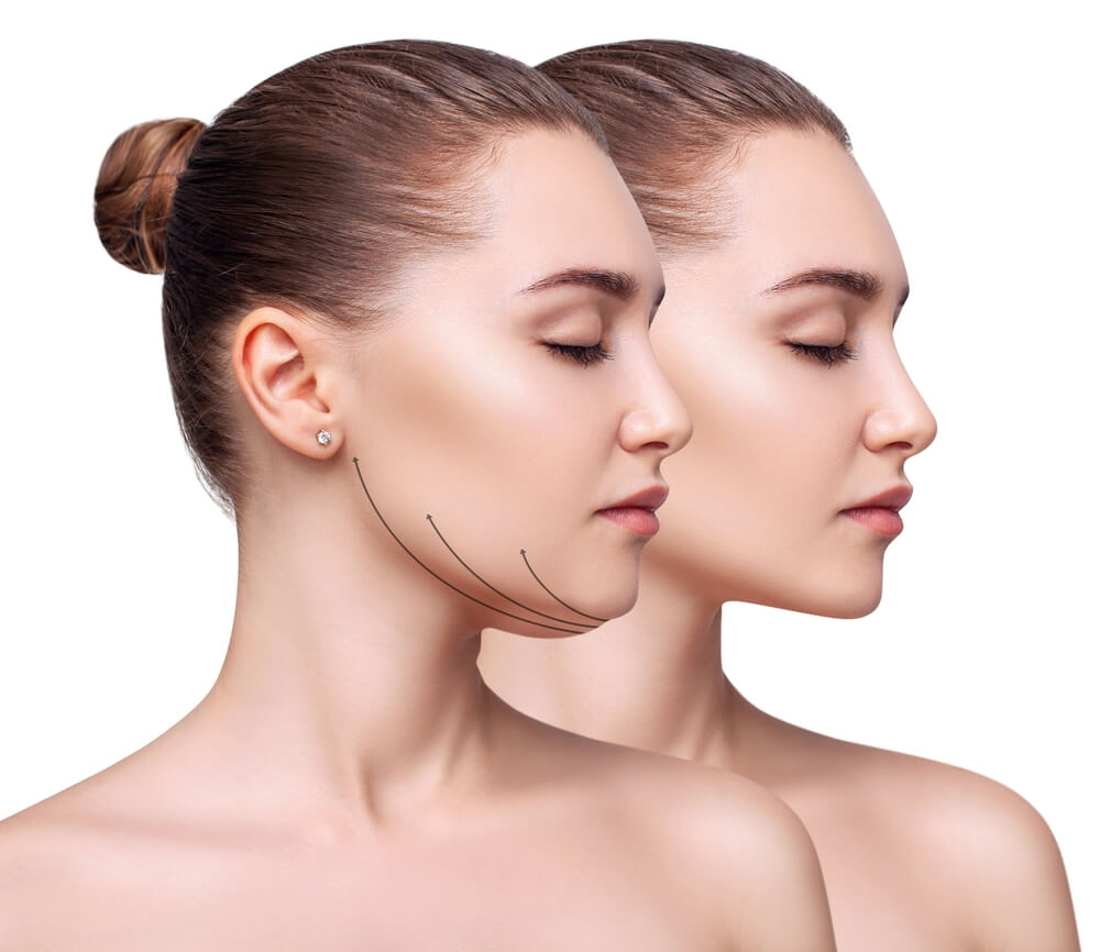 kybella destroy fat cells