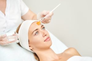 aftercare for a chemical peel