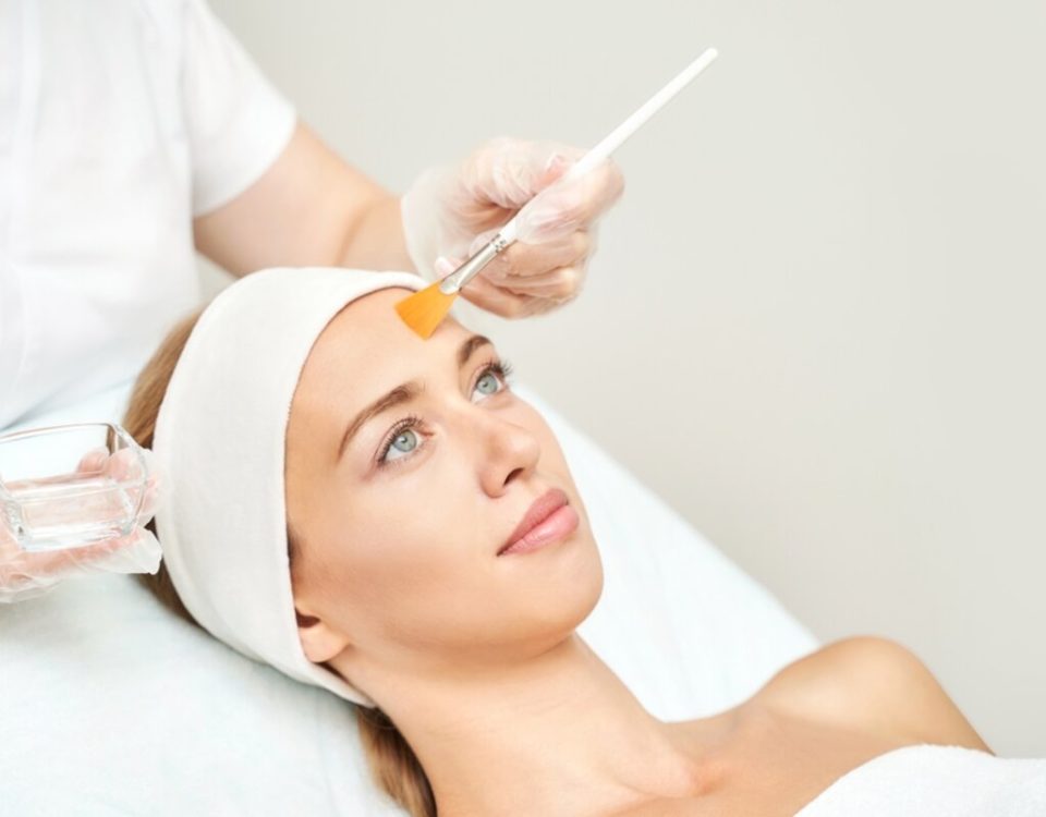aftercare for a chemical peel