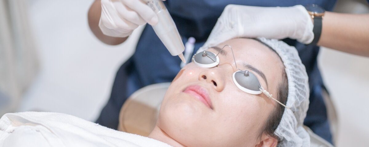What to Expect During Your First Laser Skin Treatment