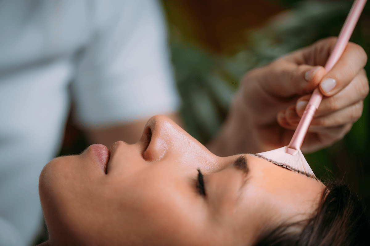 How to Prepare for a Chemical Peel - Tips for Best Results
