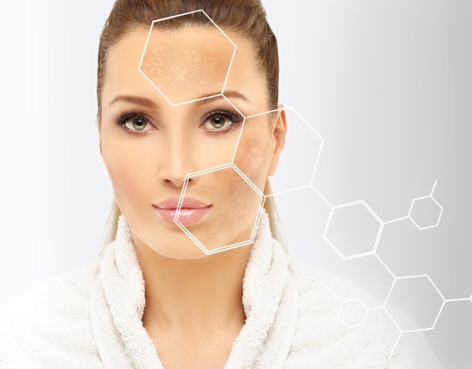 Laser Resurfacing vs. Chemical Peels: Pros and Cons